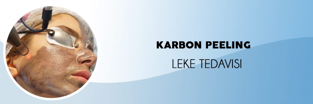 karbon-peeling-leke-tedavisi